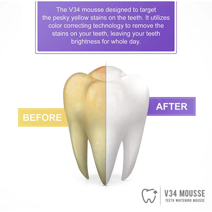 HiSmile V34 Pro Whitening Mousse