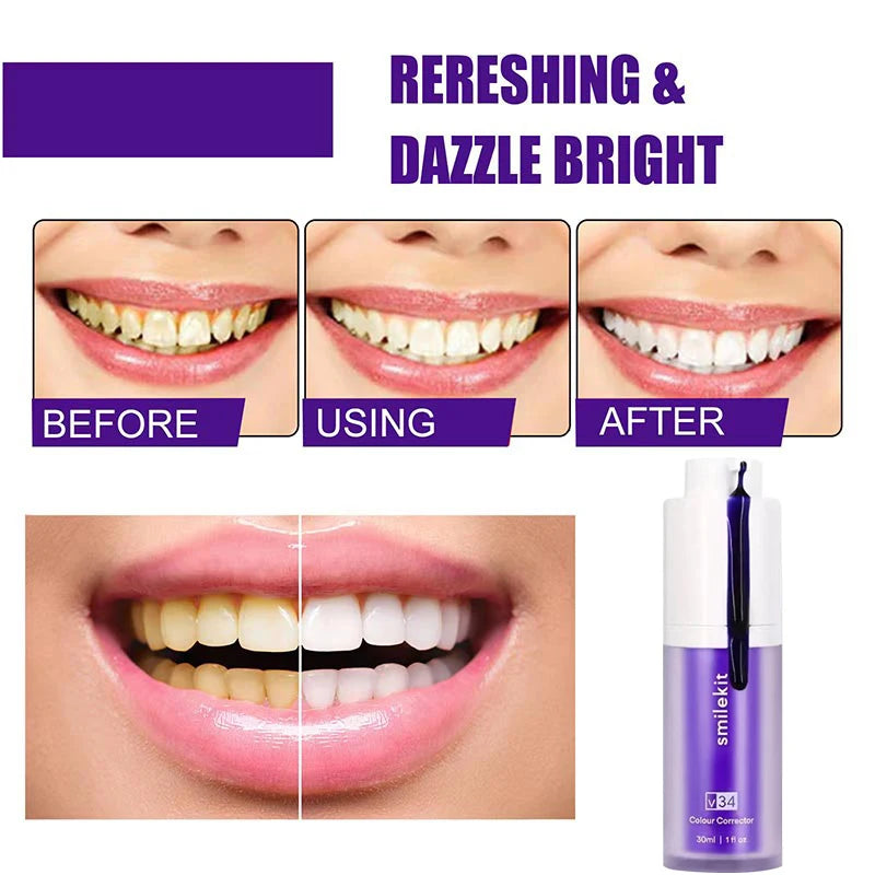 HiSmile V34 Pro Whitening Mousse